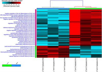 Regulation of Angiotensin- Converting Enzyme 2 in Obesity: Implications for COVID-19